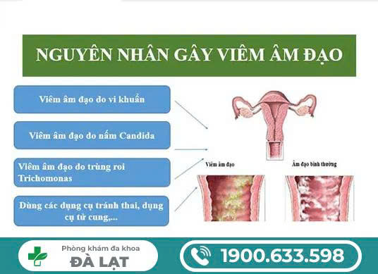 Hình ảnh minh họa